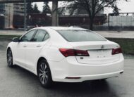 2017 ACURA TLX TECH PACKAGE