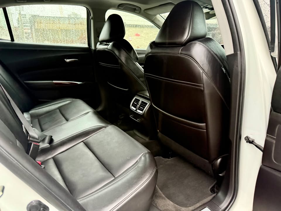 2017 ACURA TLX TECH PACKAGE