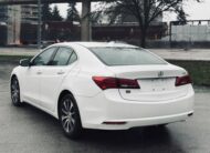 2017 ACURA TLX TECH PACKAGE