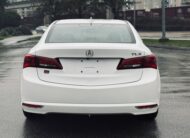 2017 ACURA TLX TECH PACKAGE
